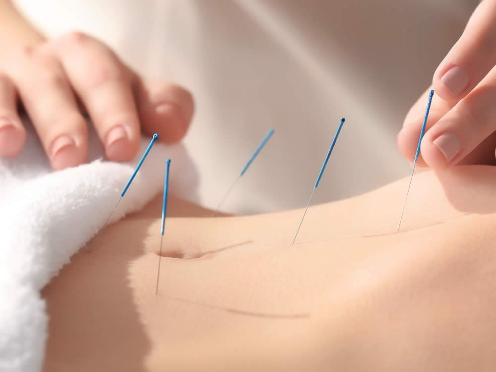 Kuru İğne Tedavisi