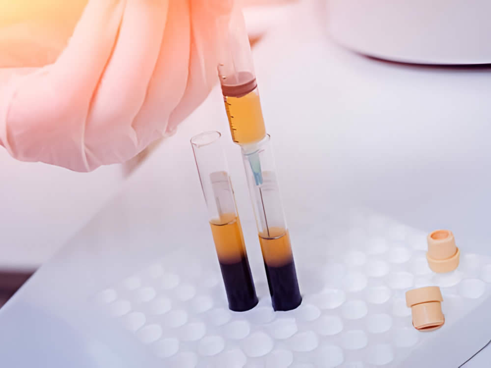 PRP / CGF Enjeksiyonu